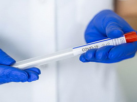 koronavirus 0287